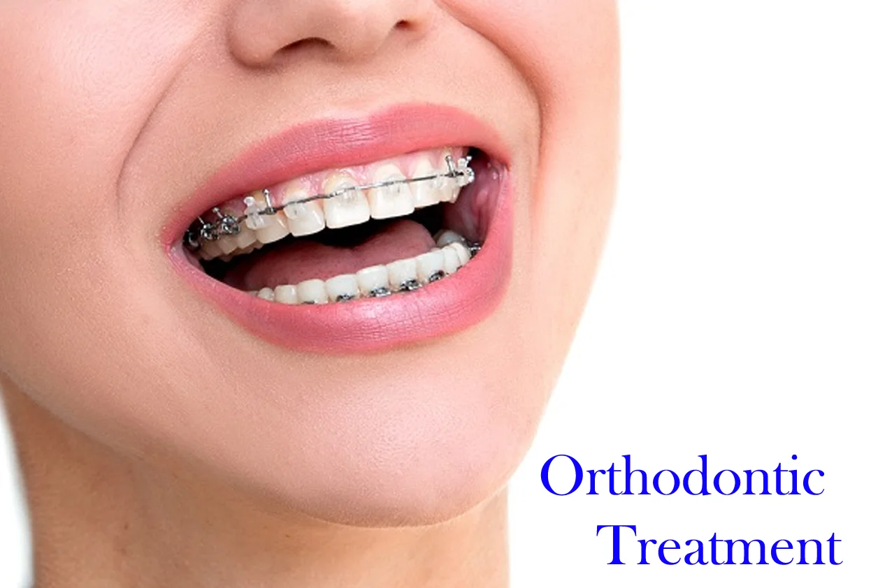 Orthodontic Treatment